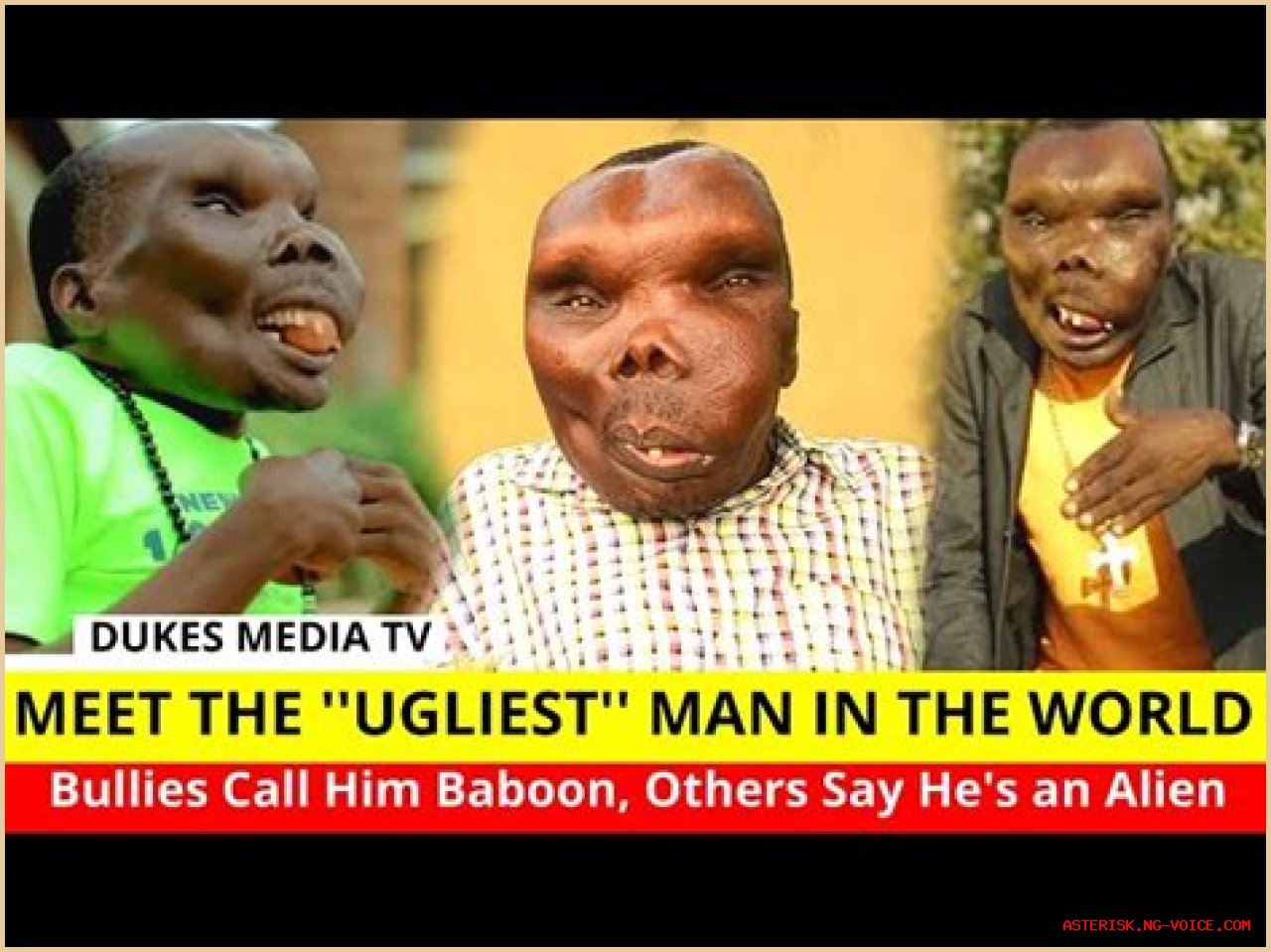 The Surprising Truth About Being Dubbed The Ugliest Person In The World